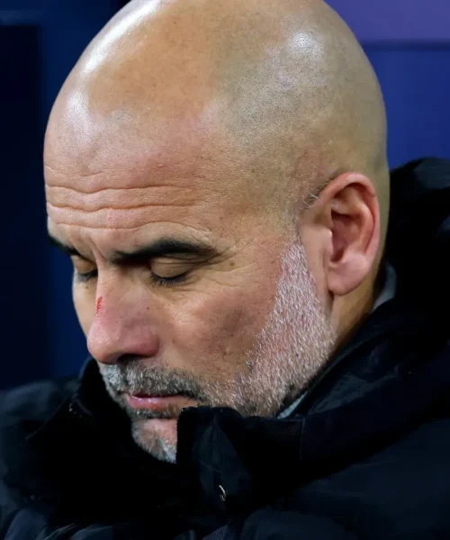 Guardiola distrutto va in TV con graffi e ferite: le sue parole spiazzano i tifosi. Foto