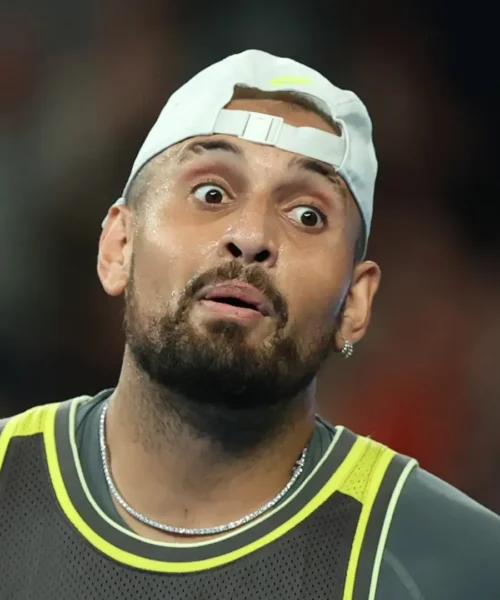 Nick Kyrgios già fuori: le sue smorfie dopo la bruciante sconfitta. Foto