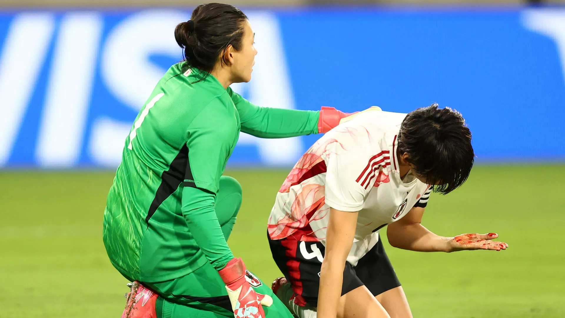 La campionessa si è ferita alla testa durante la partita contro gli Stati Uniti
